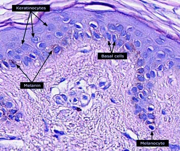 Micrograph showing melanin storage in skin cells