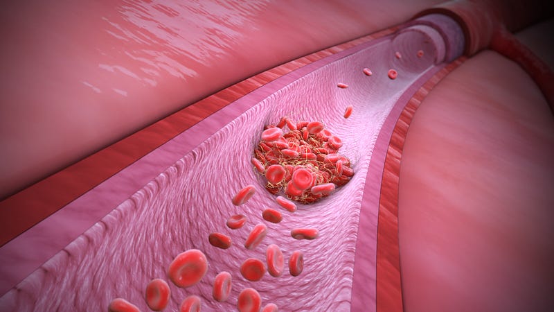 Representation of Covid-19 effects on blood vessels.