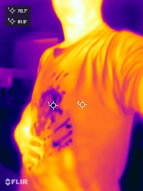 Infrared image showing temperature differences